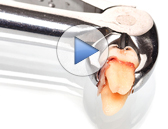 Tooth Extractions