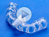 NTI and TSS Mouth Guards