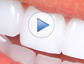 Teeth Whitening