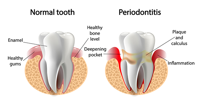 February is Heart Health Month Jon Frankel Dentistry