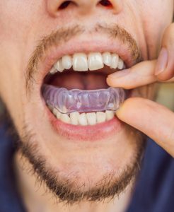 Man with mouthguard