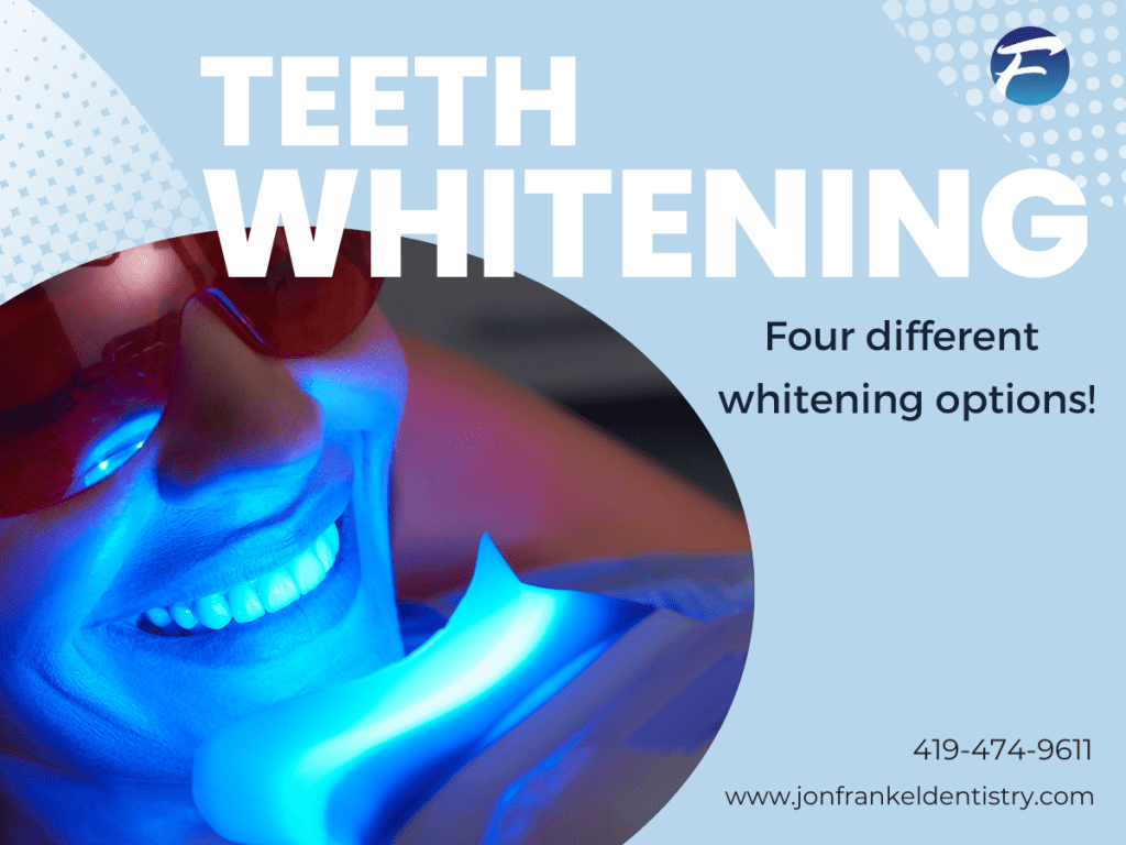 Poster for Teeth Whitening Services